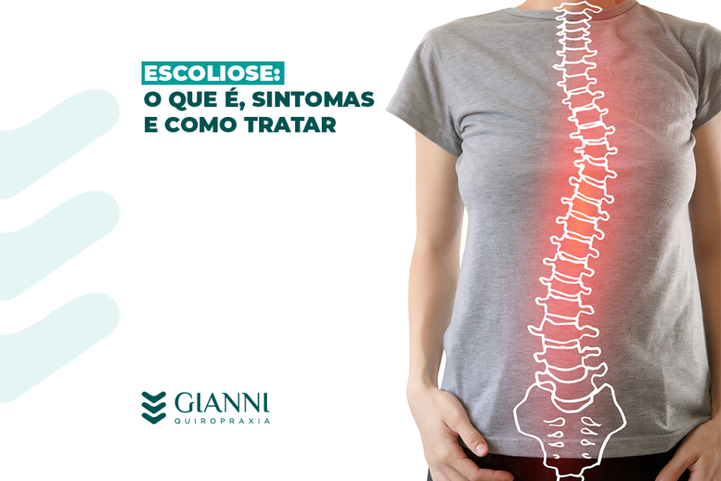 Imagem de um raio-X de um homem com escoliose