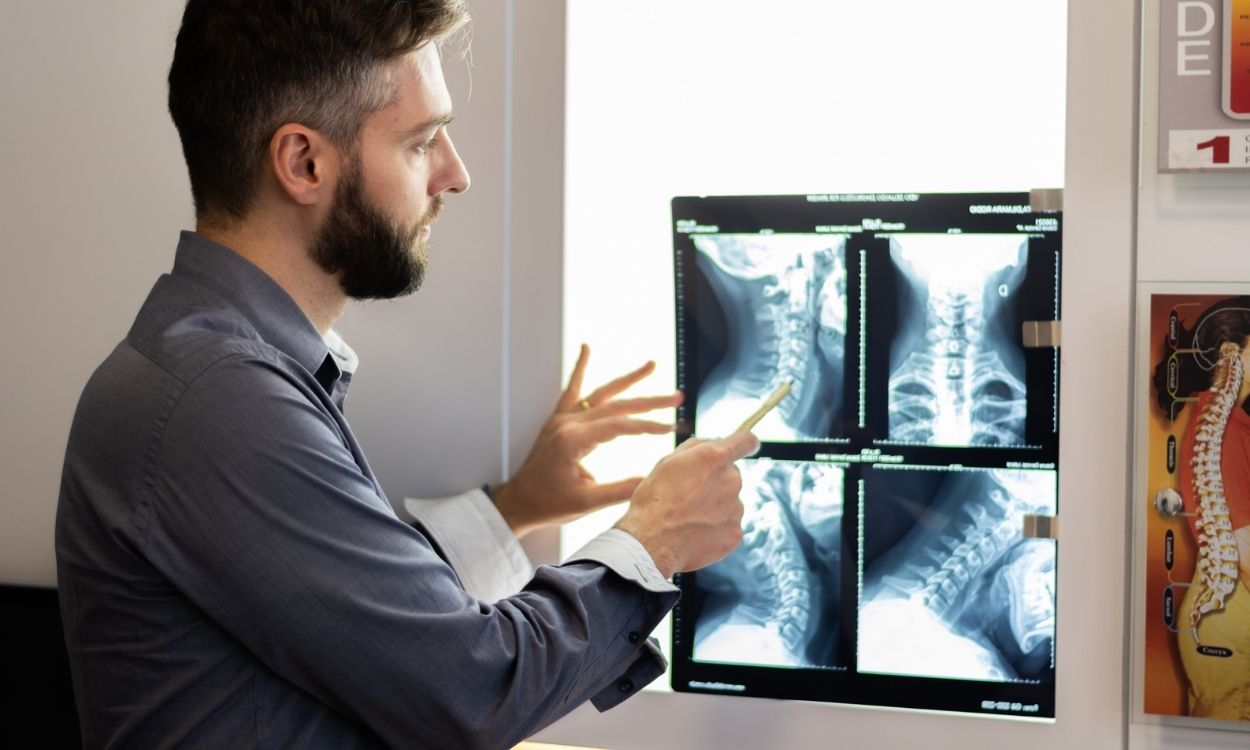 Imagem do quiropraxista Filipe Gianni apresentando uma radiografia